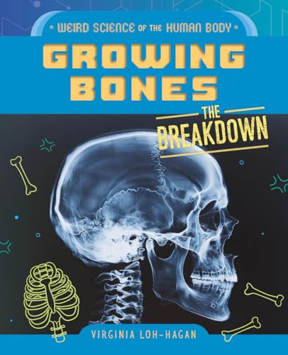 Growing Bones - Library Binding